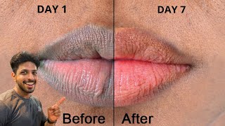 Dark To PINK LIPS!! (இயற்கை வழி) EASY Home Remedies & Tips (100% BEST Results Guaranteed)