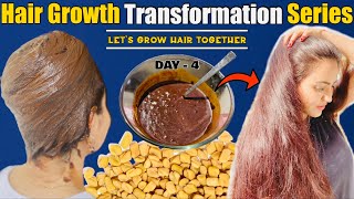 EXTREME HAIR GROWTH TRANSFORMATION CHALLENGE (Day 4) : Fix Thin,Dull,Dry & Damaged Hair Naturally💕