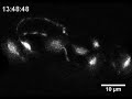 Seeking Clues to Human Brain Development by Observing C. elegans