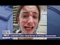 7th grader in Gardner, Illinois says school bully attacked her during gym class