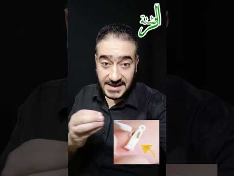 متى تسقط سرة المولود أمومة مراحل الحمل