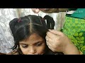 Children hairstyle in few minutes full explanation in telugu part -2