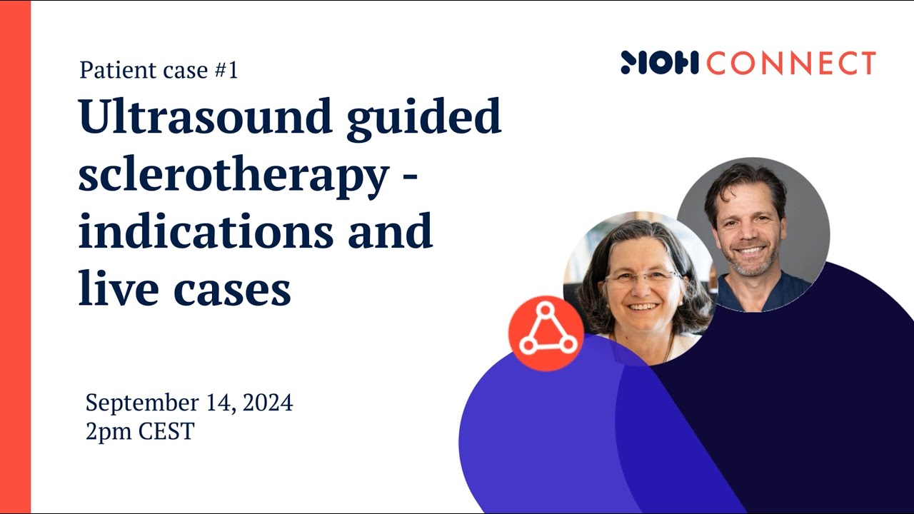 MOH Connect - Ultrasound guided sclerotherapy - indications and live cases - Patient case #1