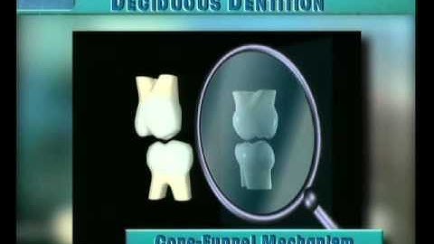 Clip 26: Cone-Funnel Mechanism