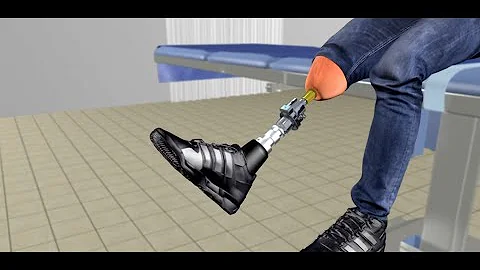 Meet the Team | HSS Osseointegration Limb Replacement Center