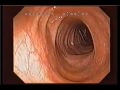 Dr Shinya the colon and Kangen Water
