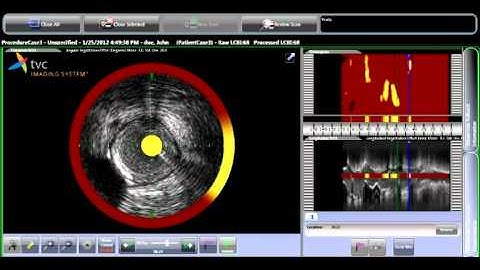 Demonstration of TVC Imaging System