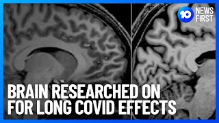 Griffith University Investigates The Effects Of Long COVID-19 | 10 News First