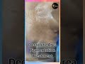 Décolleté Pigmentation Treatment | Neck & Chest Skin Brightening | Asthederm (Aesthetics By Jasmine)