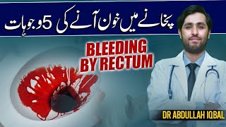 Learn the 5 Unexpected Reasons of Blood In Stool | Bleeding By Rectum | Pakhane Me Khoon Ane Ki Waja