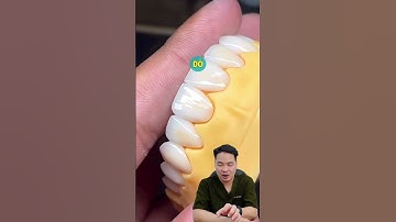 48 Giờ Để Sở Hữu Nụ Cười Hoàn Hảo #DrThu #Veneer