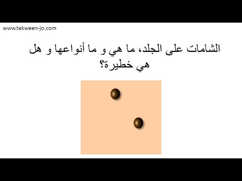 الشامات على الجلد ما هي و ما مخاطرها 