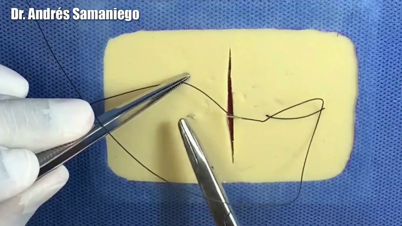 Sutura | Punto Colchonero Vertical | Sarnoff | Cirugía (Médico Real)