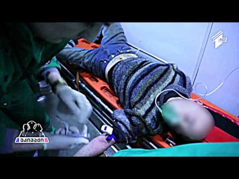 ხანძარი - თერმული დამწვრობა