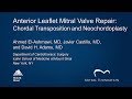 Anterior leaflet mitral valve repair chordal transposition and neochordoplasty