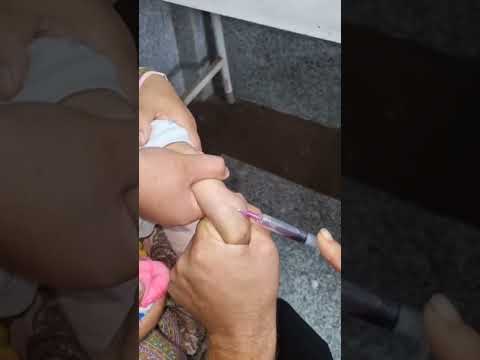 blood collection, baby