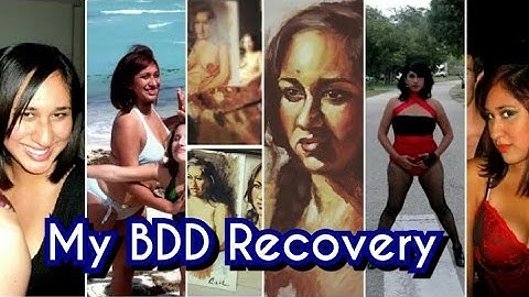 My Body Dysmorphic Disorder Recovery (2/4) [CC]