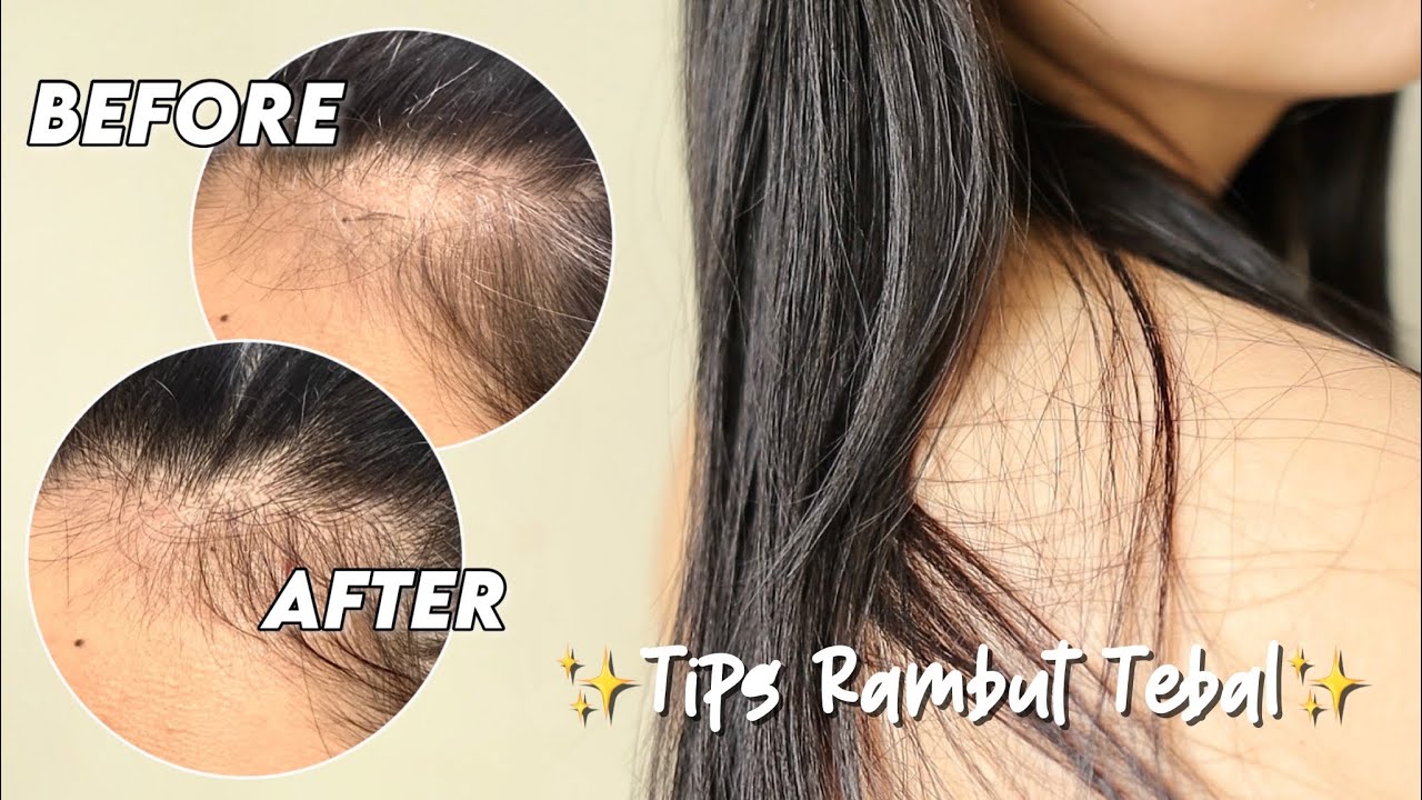Cara Menebalkan Rambut tips utk rambut rontok & tipis 🫶 YouTube