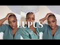 Family don't understand Lupus / Lupus as a woman of color