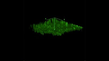 In vivo visualization of metabolically active photoreceptors in retinal organoids.