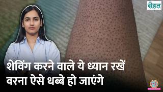 पैरों की Shaving की वजह से Strawberry Legs हुए, ये 3 चीज़ें छुटकारा दिला देंगी | Sehat 1336