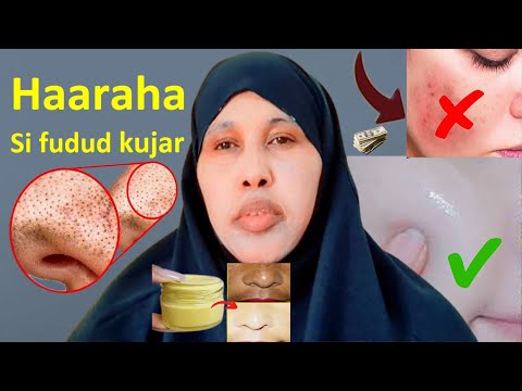 Haaraha Wajiga Sida Lugu Jaro Oo Fudud Lacag Iyadoo Kaabixin Sidaan Hadaad Samayso Nadiif Noqonaysa