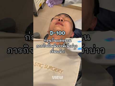 เตรียมผิวก่อนแต่งงาน 100 วัน สำหรับว่าที่เจ้าบ่าว