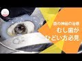治療したのに神経の先に膿が?!根管の再治療 Root Canal Retreatment Using A Microscope