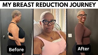 My Breast Reduction Surgery and Recovery Vlog - Answering All Of Your Questions! by DIY with KB 82,112 views 2 months ago 25 minutes