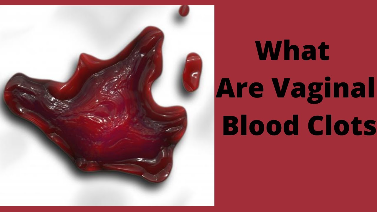 What Are Vaginal Blood Clots Youtube