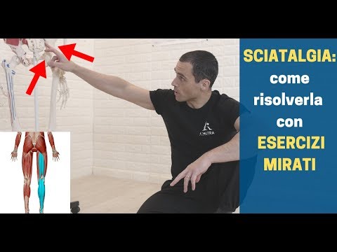 Video: Come Allenarsi con la Sciatica (con Immagini)