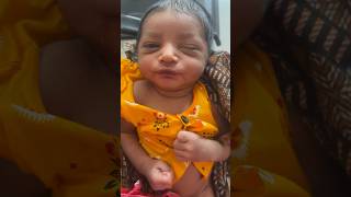 This Eye Infection#medical #baby #viral
