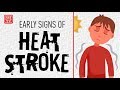 Early signs of heat stroke