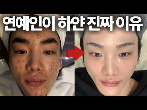 누구나 쉽게 피부 하얘지는 방법ㅣ욕 먹을 각오하고 전부 공개합니다 (진짜 간단합니다)