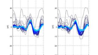 Pattern Reversal Visual Evoked Potentials (PRVEPs)