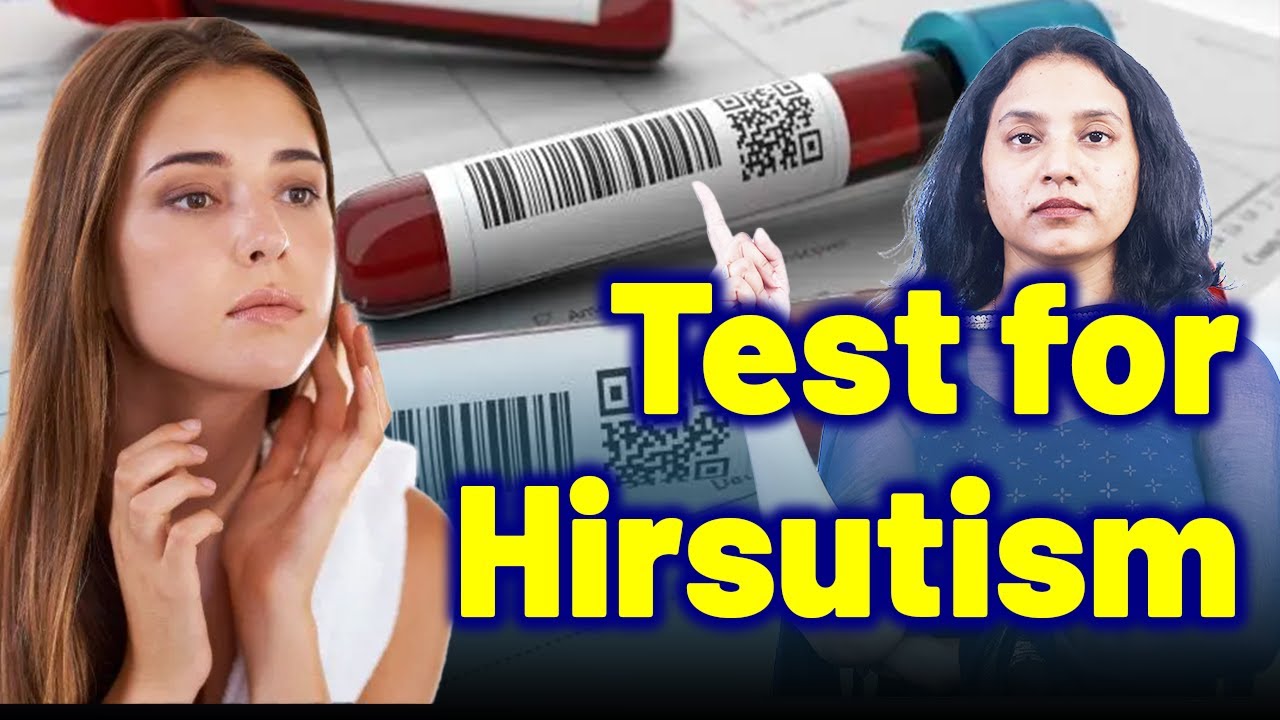 Which Tests Confirm Hirsutism? Find Out Now ! | Treatment | Homeopathy, Medicine, Cure & Surgery