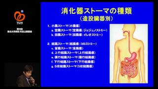 第10回市民公開講座　基調講演 　ストーマって何？どんなもの？