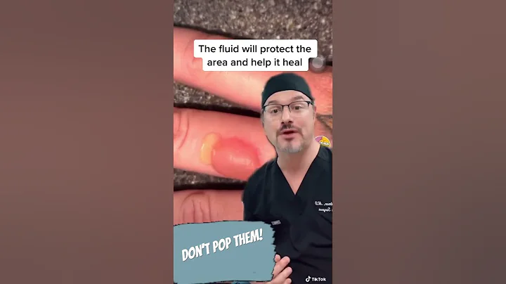Don’t pop the blister #shorts