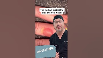Thumbnail of Don’t pop the blister #shorts