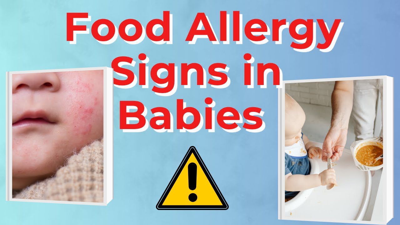 Don’t Miss These Baby Allergy Warning Signs! (Must-Know for Parents)