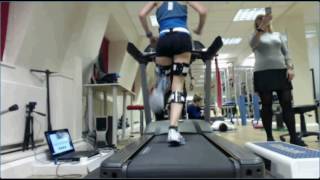 Posterior View Gait Analysis