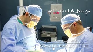 الدعامات الهيدروليك او الدعامات المرنه ؟ ايهما افضل ؟