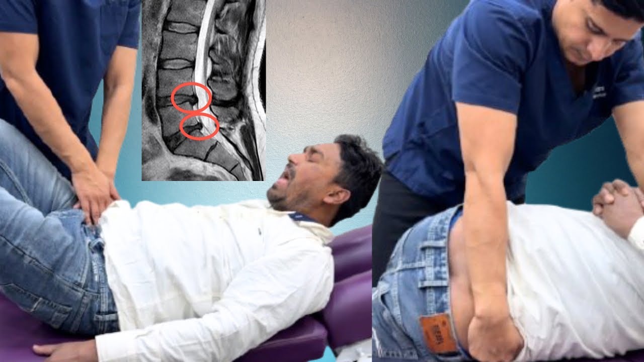 गंभीर डिस्क bulge के बाद बोल नहीं पा रहे | drchandraprakash