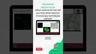 Discover the full potential of volume #ElectronMicroscopy