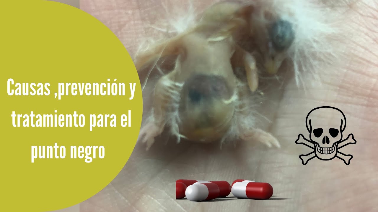 El punto negro ¿Qué es? Causas y tratamiento🦠💊🤢🐣