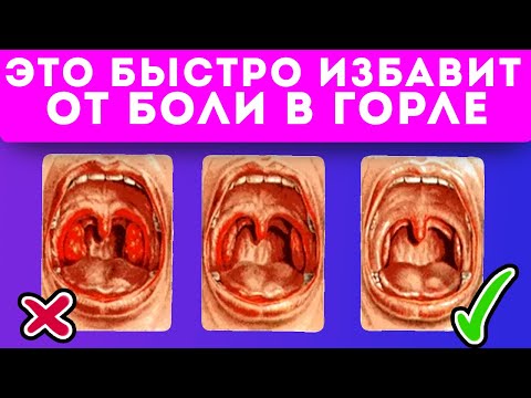 Супер средство от ангины, фарингита, ларингита, боли в горле и не только…