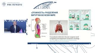 Роль торакальных хирургов в оказании помощи онкопациентам с опухолями торакальной локализации