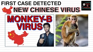 Monkey B Virus Causes, Symptoms, And Mode Of Transmission Everything You Need To Know