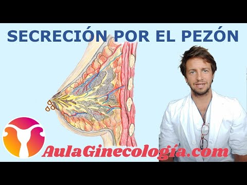 Vídeo: Secreción Del Pezón: Color, Causas Y Próximos Pasos