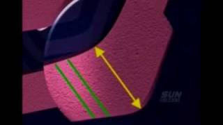 Mortein Coil India Nov 09.Wmv